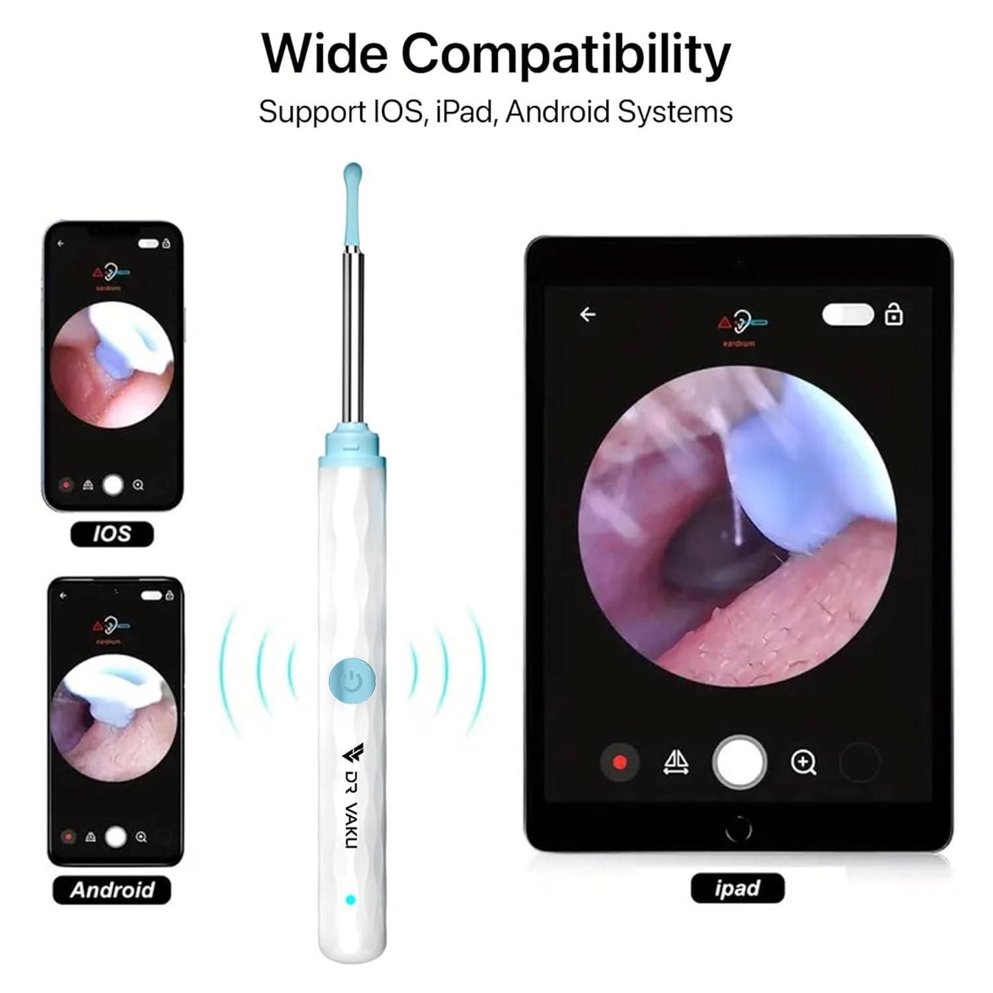 Smart Visual Ear Wax Cleaner – HD Camera, 8-in-1 Kit, Type-C Rechargeable