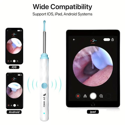 Smart Visual Ear Wax Cleaner – HD Camera, 8-in-1 Kit, Type-C Rechargeable