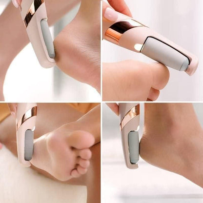 Cordless Electronic Callus Remover